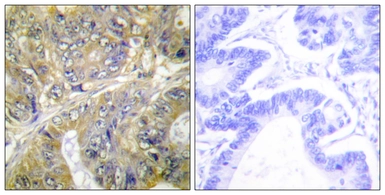 Anti-EPS8L3 antibody used in IHC (Paraffin sections) (IHC-P). GTX87073