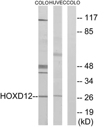 Anti-HOXD12 antibody used in Western Blot (WB). GTX87077