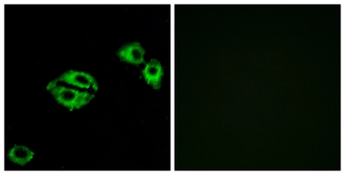 Anti-NPY5R antibody used in Immunocytochemistry/ Immunofluorescence (ICC/IF). GTX87079