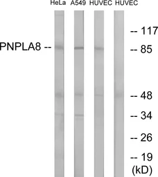 Anti-PNPLA8 antibody used in Western Blot (WB). GTX87080