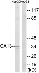 Anti-CA13 antibody used in Western Blot (WB). GTX87081
