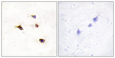 Anti-IP6K3 antibody used in IHC (Paraffin sections) (IHC-P). GTX87084