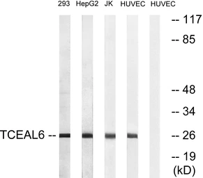 Anti-TCEAL6 antibody used in Western Blot (WB). GTX87087
