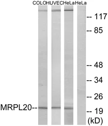 Anti-MRPL20 antibody used in Western Blot (WB). GTX87089