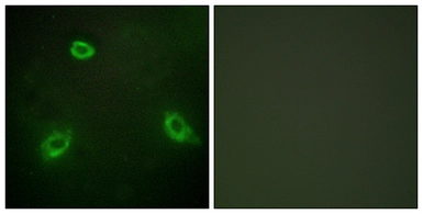 Anti-Anoctamin 7 antibody used in Immunocytochemistry/ Immunofluorescence (ICC/IF). GTX87092