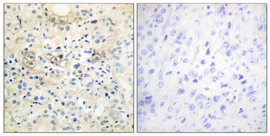 Anti-Anoctamin 7 antibody used in IHC (Paraffin sections) (IHC-P). GTX87092