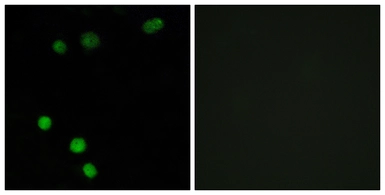 Anti-TP53INP2 antibody used in Immunocytochemistry/ Immunofluorescence (ICC/IF). GTX87093