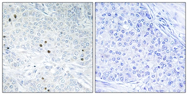 Anti-TP53INP2 antibody used in IHC (Paraffin sections) (IHC-P). GTX87093