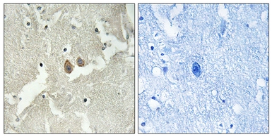 Anti-NSG2 antibody used in IHC (Paraffin sections) (IHC-P). GTX87099