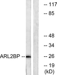 Anti-ARL2BP antibody used in Western Blot (WB). GTX87101