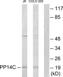 Anti-PPP1R14C antibody used in Western Blot (WB). GTX87104