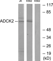 Anti-ADCK2 antibody used in Western Blot (WB). GTX87105