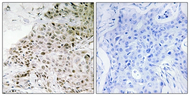 Anti-TAF13 antibody used in IHC (Paraffin sections) (IHC-P). GTX87107