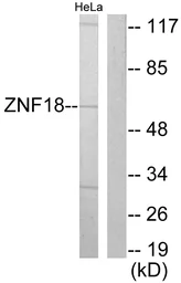 Anti-ZNF18 antibody used in Western Blot (WB). GTX87111
