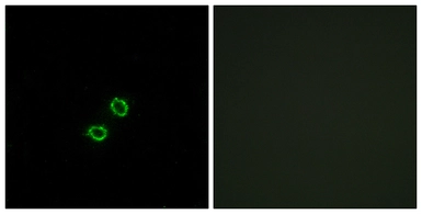 Anti-KIR2DL5B antibody used in Immunocytochemistry/ Immunofluorescence (ICC/IF). GTX87112