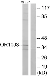 Anti-OR10J3 antibody used in Western Blot (WB). GTX87113