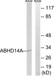 Anti-ABHD14A antibody used in Western Blot (WB). GTX87114