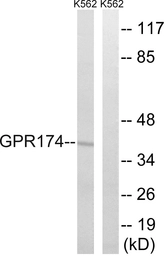 Anti-GPR174 antibody used in Western Blot (WB). GTX87118