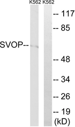 Anti-SVOP antibody used in Western Blot (WB). GTX87119