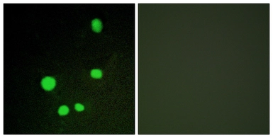 Anti-MED14 antibody used in Immunocytochemistry/ Immunofluorescence (ICC/IF). GTX87124