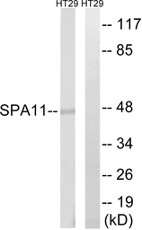 Anti-SERPINA11 antibody used in Western Blot (WB). GTX87127