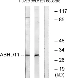 Anti-ABHD11 antibody used in Western Blot (WB). GTX87129
