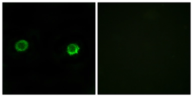 Anti-ABHD2 antibody used in Immunocytochemistry/ Immunofluorescence (ICC/IF). GTX87133