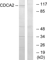 Anti-CDCA2 antibody used in Western Blot (WB). GTX87138