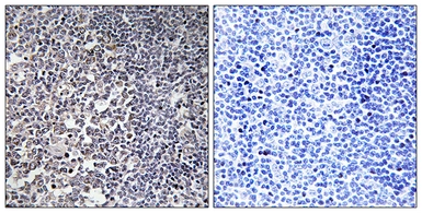 Anti-MRPS16 antibody used in IHC (Paraffin sections) (IHC-P). GTX87139