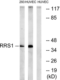 Anti-RRS1 antibody used in Western Blot (WB). GTX87140
