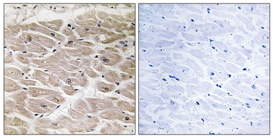 Anti-AGBL2 antibody used in IHC (Paraffin sections) (IHC-P). GTX87142