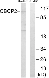 Anti-AGBL2 antibody used in Western Blot (WB). GTX87142