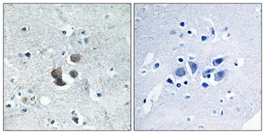 Anti-IGFBP7 antibody used in IHC (Paraffin sections) (IHC-P). GTX87146