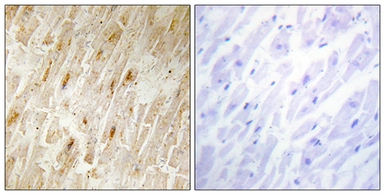 Anti-BCA3 antibody used in IHC (Paraffin sections) (IHC-P). GTX87149