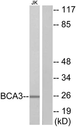 Anti-BCA3 antibody used in Western Blot (WB). GTX87149