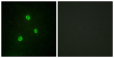 Anti-TBX1 antibody used in Immunocytochemistry/ Immunofluorescence (ICC/IF). GTX87150