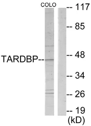 Anti-TBX1 antibody used in Western Blot (WB). GTX87150
