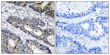 Anti-GLB1L3 antibody used in IHC (Paraffin sections) (IHC-P). GTX87152