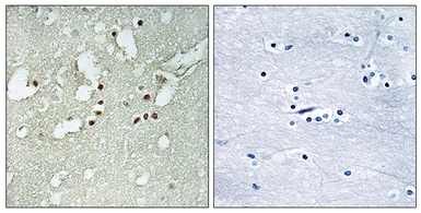 Anti-FOXJ3 antibody used in IHC (Paraffin sections) (IHC-P). GTX87156