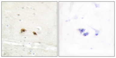 Anti-EGR3 antibody used in IHC (Paraffin sections) (IHC-P). GTX87158