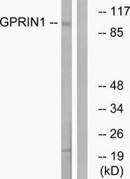 Anti-GPRIN1 antibody used in Western Blot (WB). GTX87160
