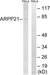 Anti-ARPP21 antibody used in Western Blot (WB). GTX87161