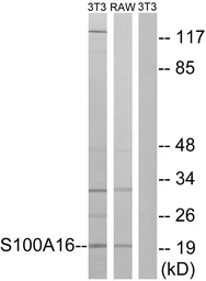 Anti-S100A16 antibody used in Western Blot (WB). GTX87170