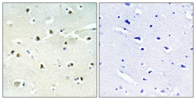 Anti-S100A16 antibody used in IHC (Paraffin sections) (IHC-P). GTX87170