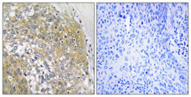 Anti-S100A16 antibody used in IHC (Paraffin sections) (IHC-P). GTX87170