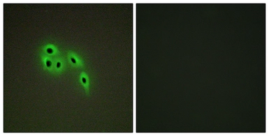 Anti-DOK6 antibody used in Immunocytochemistry/ Immunofluorescence (ICC/IF). GTX87172