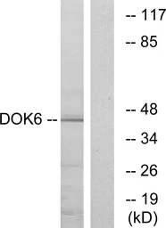 Anti-DOK6 antibody used in Western Blot (WB). GTX87172