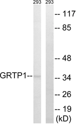 Anti-GRTP1 antibody used in Western Blot (WB). GTX87173