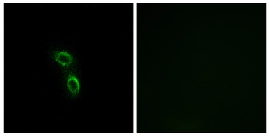 Anti-ARMC6 antibody used in Immunocytochemistry/ Immunofluorescence (ICC/IF). GTX87183
