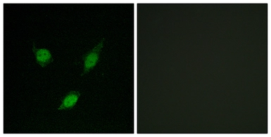 Anti-TACC1 antibody used in Immunocytochemistry/ Immunofluorescence (ICC/IF). GTX87189